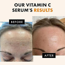 Ecelet Vitamin C+ Advanced Brightening Serum – Powered by Hyaluronic Acid, Niacinamide, Retinol & Salicylic Acid for Even-Tone, Hydrated, and Radiant Skin (1 fl oz / 30 mL)