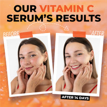 Ecelet Vitamin C+ Advanced Brightening Serum – Powered by Hyaluronic Acid, Niacinamide, Retinol & Salicylic Acid for Even-Tone, Hydrated, and Radiant Skin (1 fl oz / 30 mL)